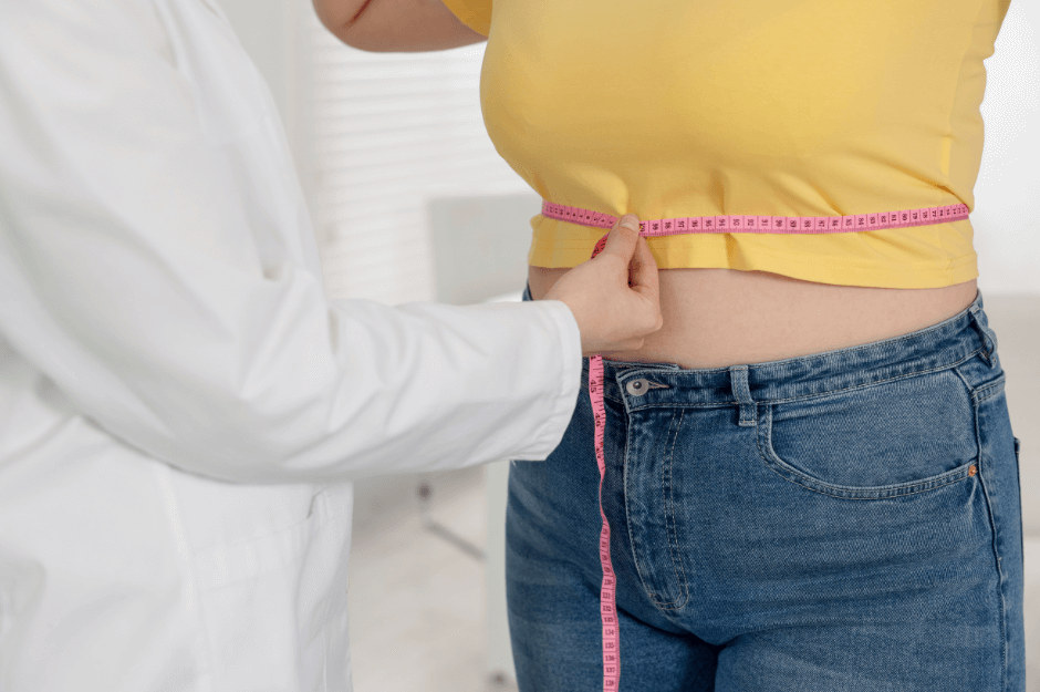 Surgical Weight Loss info 